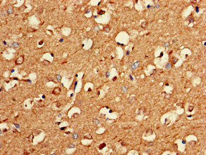 PNMA2 Antibody