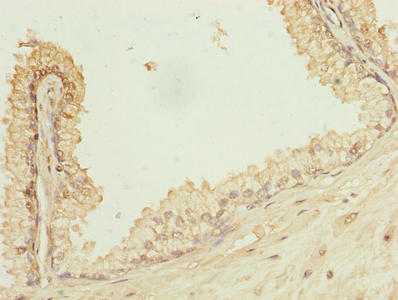 POGZ Antibody