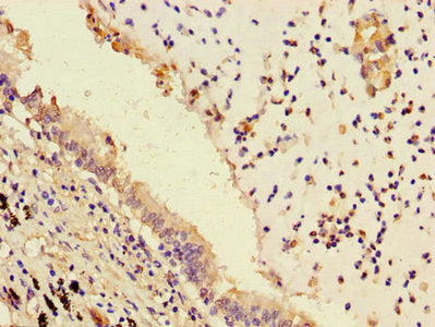 PLPP3 Antibody