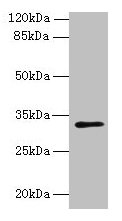 PLPP2 Antibody