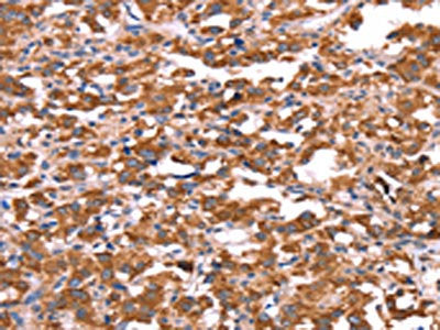 FXR1 Antibody