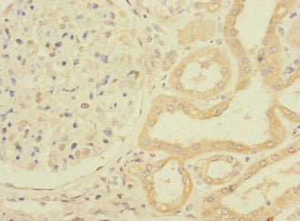 PPIAL4G Antibody