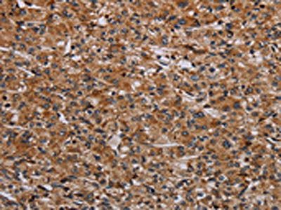 RPS6KB2 Antibody