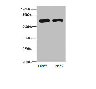 PPM1D Antibody