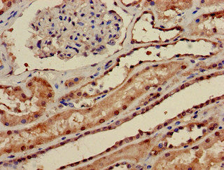 PPP1CA Antibody