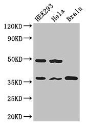 PPP1CC Antibody