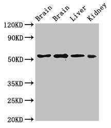 PPP2R2A Antibody