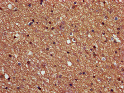 PPP2R2B Antibody