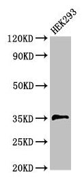 PPT1 Antibody