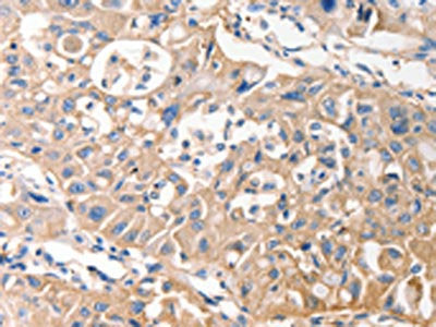 MVP Antibody
