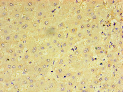 PRAME Antibody