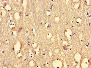 PRMT5 Antibody