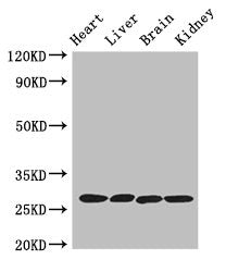 PRSS2 Antibody