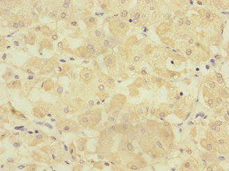 TMPRSS15 Antibody