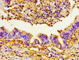 PRTN3 Antibody