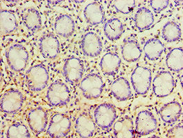 PSCA Antibody