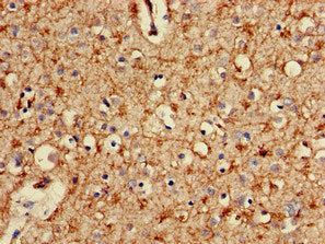 PSMA2 Antibody