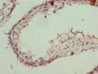 PSMD10 Antibody