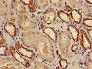 PSMD9 Antibody
