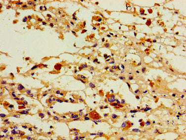 PTGIS Antibody