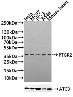 PTGR2 Antibody