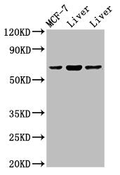 PTH1R Antibody