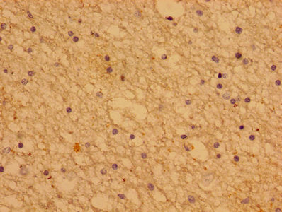 PTHLH Antibody