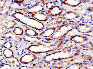 PTK2 Antibody