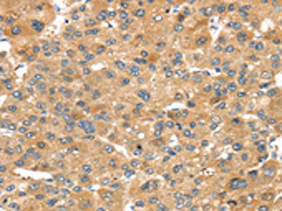 NOX3 Antibody