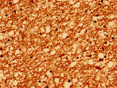 PTPRZ1 Antibody