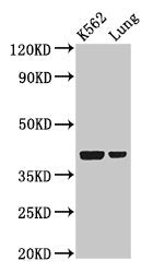 PTX3 Antibody