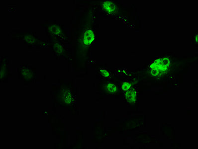 PVALB Antibody
