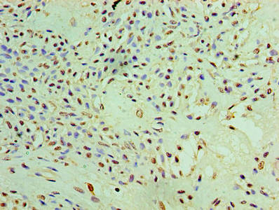 PYCR1 Antibody