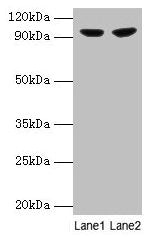 PYGL Antibody