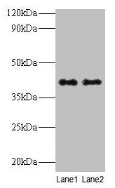 QPCT Antibody
