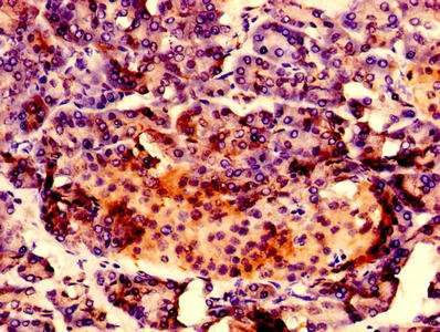 RAB10 Antibody