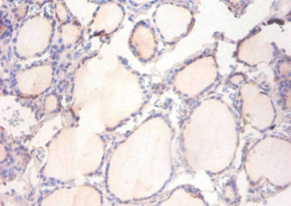 ADAM15 Antibody