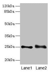 RAB3B Antibody