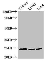 RAB5A Antibody