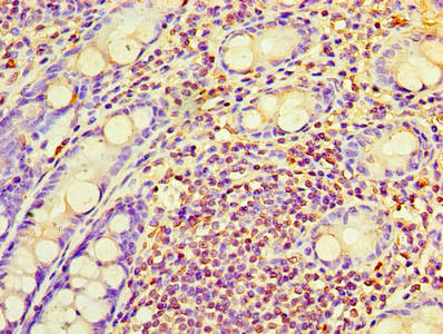 RAB6A Antibody