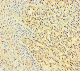 RAC2 Antibody