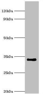 RAD1 Antibody
