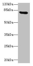 RAD17 Antibody