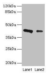 RAD23B Antibody