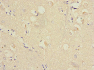RAP2B Antibody