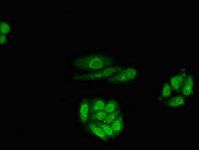 RARB Antibody