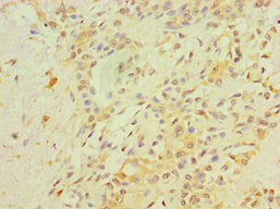 RB1 Antibody