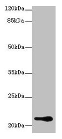 RBBP9 Antibody
