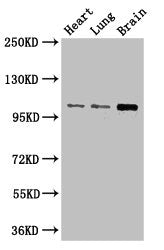 RBM10 Antibody