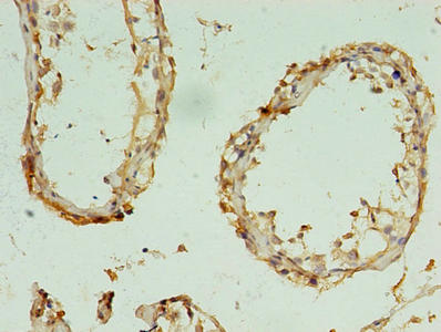 RBM11 Antibody